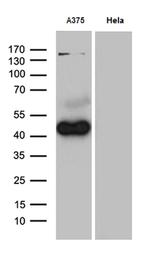 PHLDA1 Antibody in Western Blot (WB)