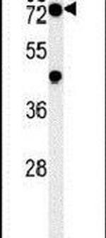 PHTF2 Antibody in Western Blot (WB)