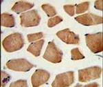PHYH Antibody in Immunohistochemistry (IHC)