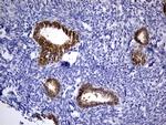 PHYHD1 Antibody in Immunohistochemistry (Paraffin) (IHC (P))