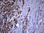 PHYHD1 Antibody in Immunohistochemistry (Paraffin) (IHC (P))