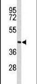 PHYH Antibody in Western Blot (WB)