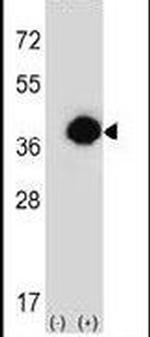 PHYH Antibody in Western Blot (WB)