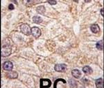 PI4K2B Antibody in Immunohistochemistry (IHC)