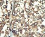 PI4K2B Antibody in Immunohistochemistry (IHC)