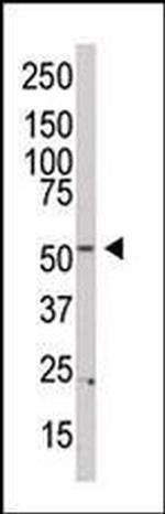 PI4K2B Antibody in Western Blot (WB)