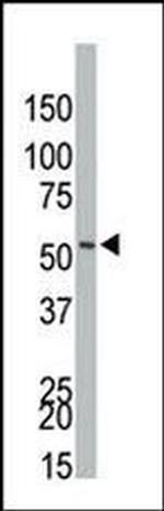 PI3K p55 gamma Antibody in Western Blot (WB)