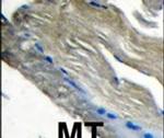 PIK3CG Antibody in Immunohistochemistry (IHC)
