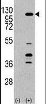 PIK3CG Antibody in Western Blot (WB)