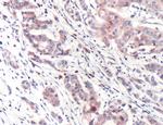 PI3K p85 alpha Antibody in Immunohistochemistry (IHC)