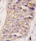 PIK3C2B Antibody in Immunohistochemistry (IHC)