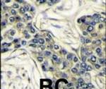 PIK3CA Antibody in Immunohistochemistry (IHC)
