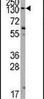 PIK3CA Antibody in Western Blot (WB)