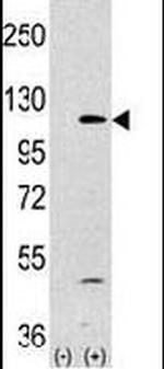 PIK3CA Antibody in Western Blot (WB)
