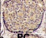 PIK3CB Antibody in Immunohistochemistry (IHC)