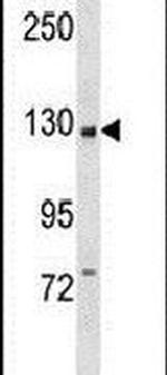 PIK3CB Antibody in Western Blot (WB)