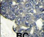 PIK3CD Antibody in Immunohistochemistry (IHC)
