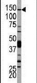 PIK3CD Antibody in Western Blot (WB)