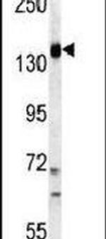 PIK3CG Antibody in Western Blot (WB)