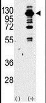 PIK3CG Antibody in Western Blot (WB)