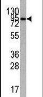 PI3K p85 alpha Antibody in Western Blot (WB)