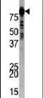 PI3K p85 alpha Antibody in Western Blot (WB)