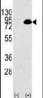 PI3K p85 alpha Antibody in Western Blot (WB)