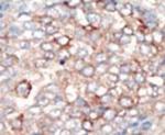 PIK3R4 Antibody in Immunohistochemistry (IHC)