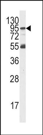PIK3R5 Antibody in Western Blot (WB)