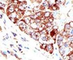 PIAS1 Antibody in Immunohistochemistry (IHC)