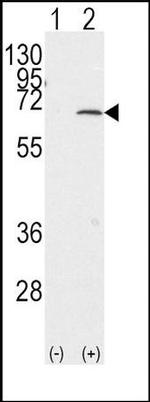 PIAS1 Antibody in Western Blot (WB)