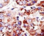 PIAS2 Antibody in Immunohistochemistry (IHC)