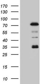 PIAS2 Antibody in Western Blot (WB)
