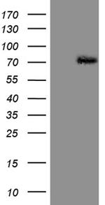 PIAS2 Antibody in Western Blot (WB)