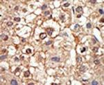 PIASy Antibody in Immunohistochemistry (IHC)