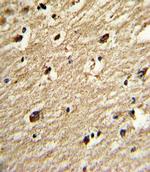 PIASy Antibody in Immunohistochemistry (IHC)