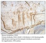 PICK1 Polyclonal Antibody