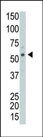 PICK1 Antibody in Western Blot (WB)
