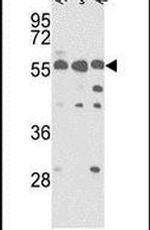 PICK1 Antibody in Western Blot (WB)
