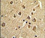 MTA2 Antibody in Immunohistochemistry (IHC)