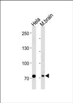 MTA2 Antibody in Western Blot (WB)