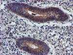 PIH1D2 Antibody in Immunohistochemistry (Paraffin) (IHC (P))