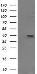 PIH1D2 Antibody in Western Blot (WB)