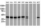 PIH1D2 Antibody in Western Blot (WB)