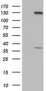 PIH1D2 Antibody in Western Blot (WB)