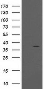 PIH1D2 Antibody in Western Blot (WB)