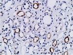 PIK3AP1 Antibody in Immunohistochemistry (Paraffin) (IHC (P))