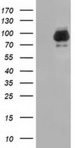 PIK3AP1 Antibody in Western Blot (WB)