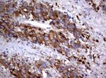PIK3C2A Antibody in Immunohistochemistry (Paraffin) (IHC (P))