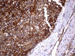 PIK3C2A Antibody in Immunohistochemistry (Paraffin) (IHC (P))